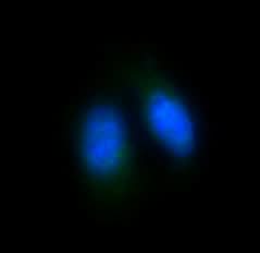 Anti-FoxO4/Afx Rabbit Monoclonal Antibody Boster Bio