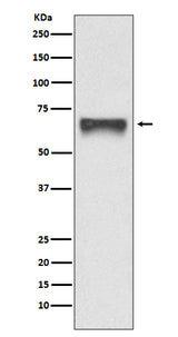 Anti-FoxO4/Afx Rabbit Monoclonal Antibody Boster Bio