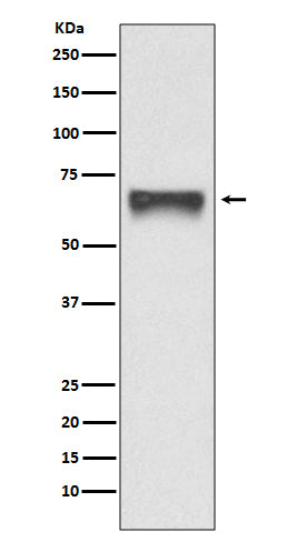 Anti-FoxO4/Afx Rabbit Monoclonal Antibody Boster Bio