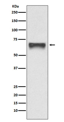 Anti-FoxO4/Afx Rabbit Monoclonal Antibody Boster Bio