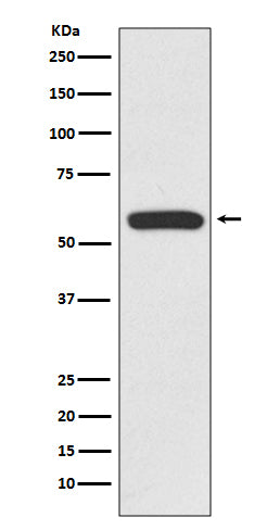 Anti-IRF6 Rabbit Monoclonal Antibody Boster Bio