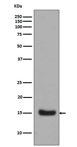 Anti-Midkine MDK Rabbit Monoclonal Antibody Boster Bio