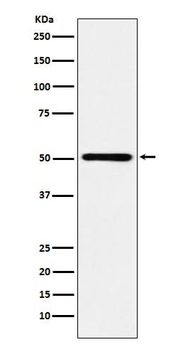 Anti-RING1 Rabbit Monoclonal Antibody Boster Bio