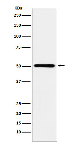 Anti-RING1 Rabbit Monoclonal Antibody Boster Bio
