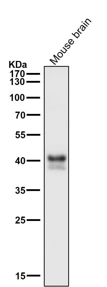 Anti-JunB Rabbit Monoclonal Antibody Boster Bio