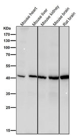 Anti-Spermine synthase Rabbit Monoclonal Antibody Boster Bio