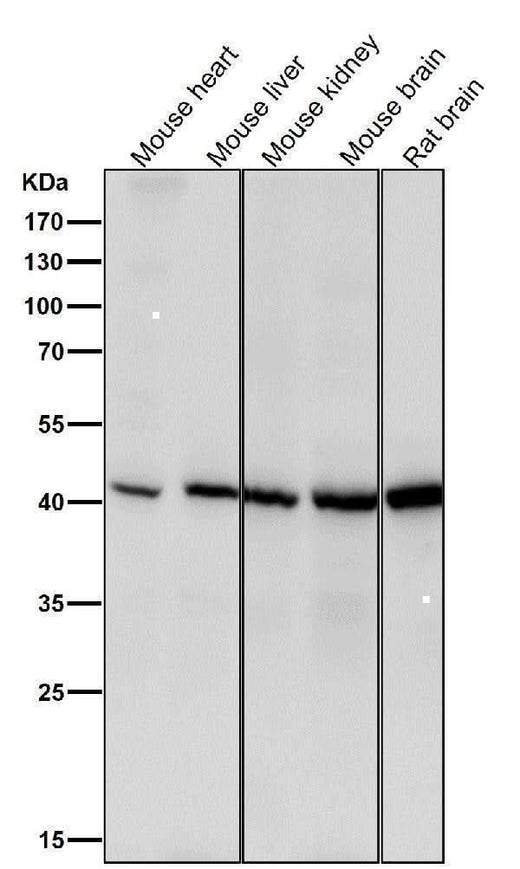 Anti-Spermine synthase Rabbit Monoclonal Antibody Boster Bio