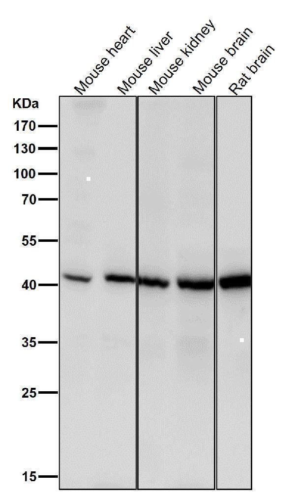 Anti-Spermine synthase Rabbit Monoclonal Antibody Boster Bio