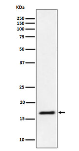 Anti-Ube2L3 / UBCH7 Rabbit Monoclonal Antibody Boster Bio