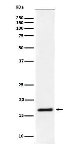 Anti-Ube2L3 / UBCH7 Rabbit Monoclonal Antibody Boster Bio