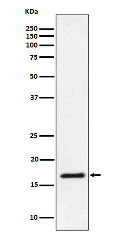 Anti-Ube2L3 / UBCH7 Rabbit Monoclonal Antibody Boster Bio