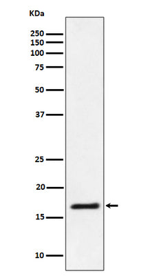 Anti-Ube2L3 / UBCH7 Rabbit Monoclonal Antibody Boster Bio
