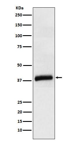 Anti-APOL1 Rabbit Monoclonal Antibody Boster Bio