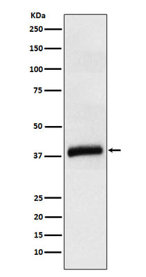 Anti-APOL1 Rabbit Monoclonal Antibody Boster Bio
