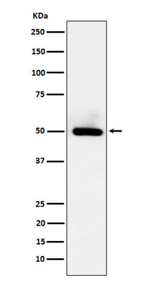 Anti-BMP15 Rabbit Monoclonal Antibody Boster Bio