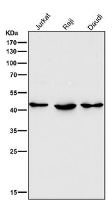 Anti-HDAC8/Histone Deacetylase 8 Rabbit Monoclonal Antibody Boster Bio