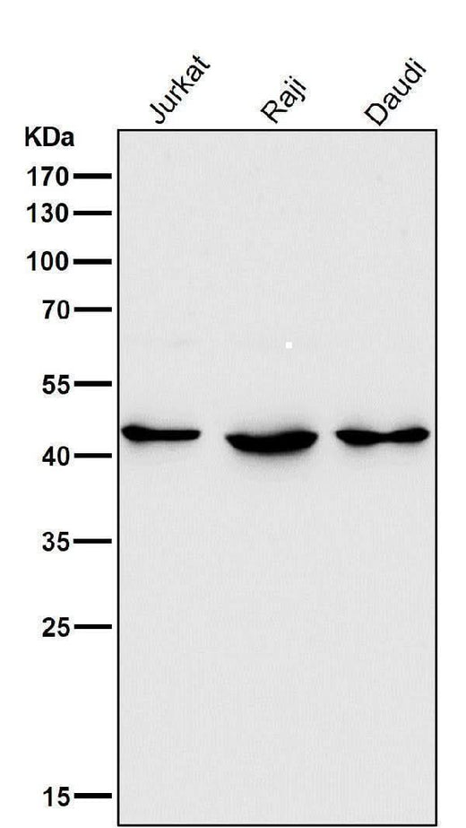 Anti-HDAC8/Histone Deacetylase 8 Rabbit Monoclonal Antibody Boster Bio