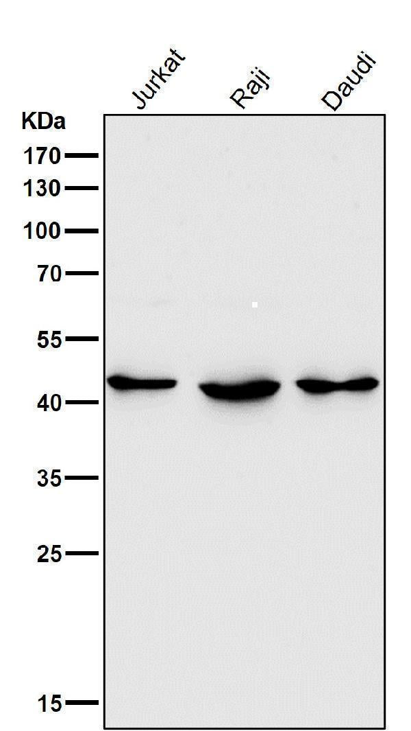Anti-HDAC8/Histone Deacetylase 8 Rabbit Monoclonal Antibody Boster Bio