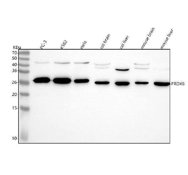 Anti-PRDX6/Peroxiredoxin 6 Rabbit Monoclonal Antibody Boster Bio