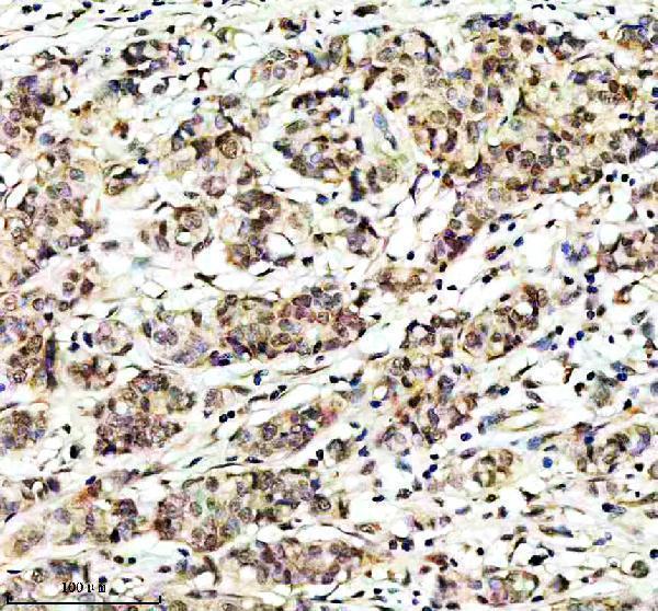 Anti-JAB1 Monoclonal Antibody Boster Bio