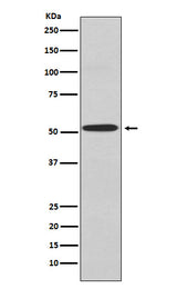 Anti-Kir2.1 Rabbit Monoclonal Antibody Boster Bio