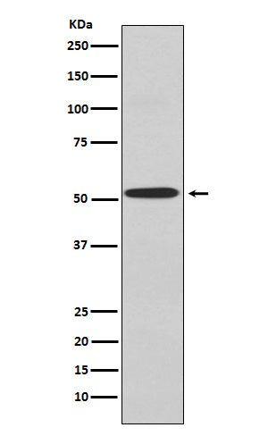 Anti-Kir2.1 Rabbit Monoclonal Antibody Boster Bio