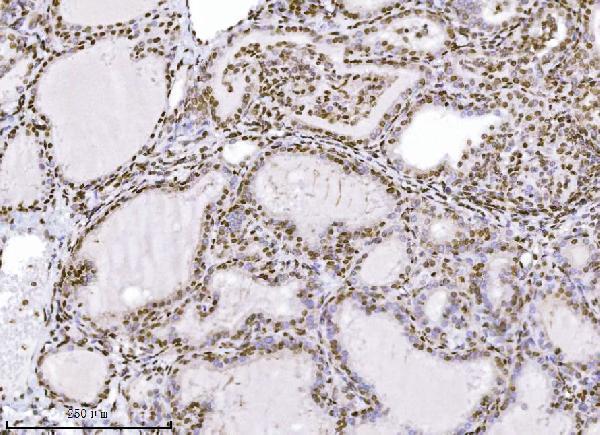 Anti-KPNB1 Antibody Picoband® (monoclonal, 3I11F2 Boster Bio
