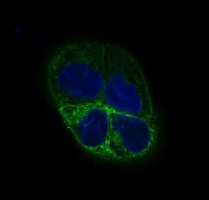 Anti-beta III Tubulin TUBB3 Rabbit Monoclonal Antibody Boster Bio