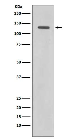 Anti-Rad21 Rabbit Monoclonal Antibody Boster Bio