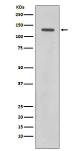 Anti-Rad21 Rabbit Monoclonal Antibody Boster Bio