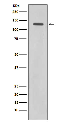 Anti-Rad21 Rabbit Monoclonal Antibody Boster Bio