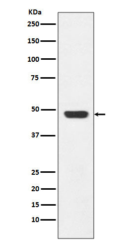 Anti-GAP43 Rabbit Monoclonal Antibody Boster Bio