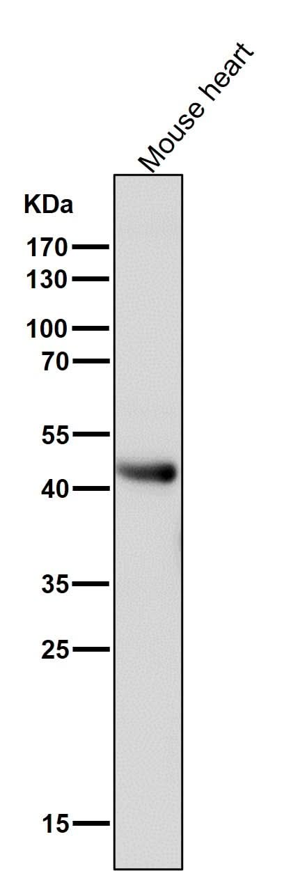 Anti-ADIPOR1 Rabbit Monoclonal Antibody Boster Bio