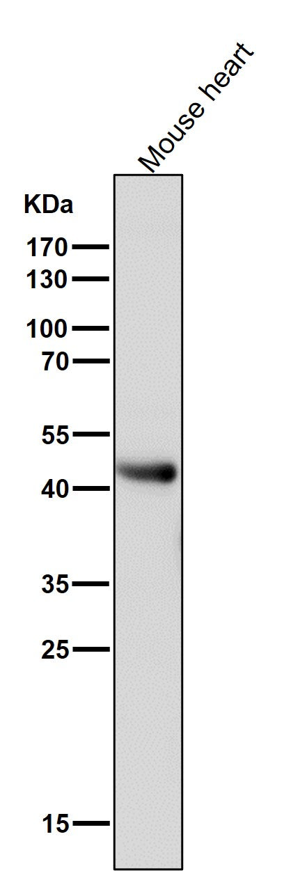 Anti-ADIPOR1 Rabbit Monoclonal Antibody Boster Bio