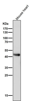 Anti-ADIPOR1 Rabbit Monoclonal Antibody Boster Bio