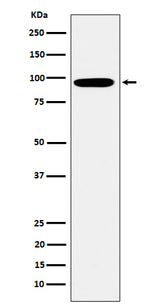 Anti-Epsin 1 Rabbit Monoclonal Antibody Boster Bio