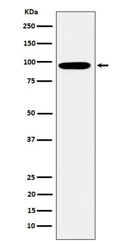 Anti-Epsin 1 Rabbit Monoclonal Antibody Boster Bio