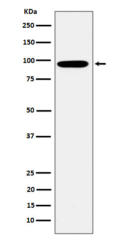 Anti-Epsin 1 Rabbit Monoclonal Antibody Boster Bio