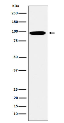 Anti-Epsin 1 Rabbit Monoclonal Antibody Boster Bio