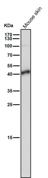 Anti-TMEM173 Monoclonal Antibody Boster Bio
