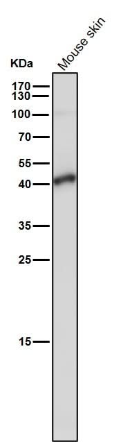 Anti-TMEM173 Monoclonal Antibody Boster Bio