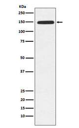 Anti-Xanthine Oxidase Rabbit Monoclonal Antibody Boster Bio