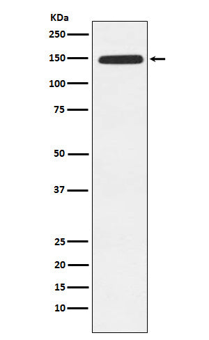Anti-Xanthine Oxidase Rabbit Monoclonal Antibody Boster Bio