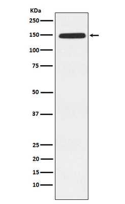 Anti-Xanthine Oxidase Rabbit Monoclonal Antibody Boster Bio