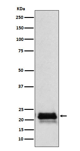 Anti-FSH beta (FSHB) Monoclonal Antibody Boster Bio