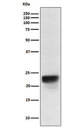 Anti-FSH beta Rabbit Monoclonal Antibody Boster Bio