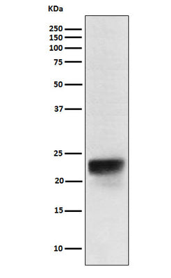 Anti-FSH beta Rabbit Monoclonal Antibody Boster Bio
