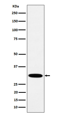 Anti-HMGCL Rabbit Monoclonal Antibody Boster Bio