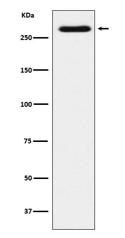 Anti-SorLA Rabbit Monoclonal Antibody Boster Bio