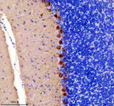 Anti-PKC gamma Rabbit Monoclonal Antibody Boster Bio
